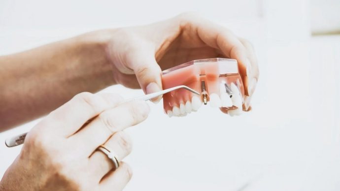 Участникам СВО в Подмосковье будут бесплатно изготавливать зубные протезы и коронки