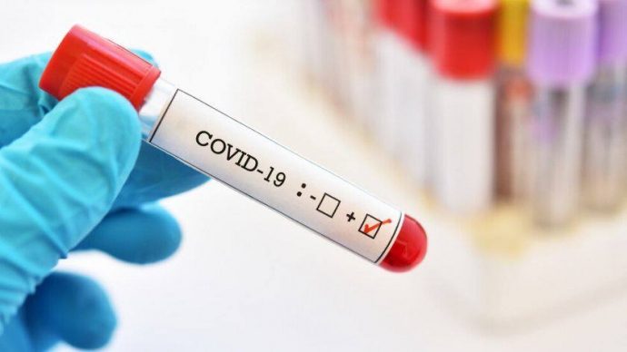 Темпы снижения заболеваемости коронавирусом в России замедляются