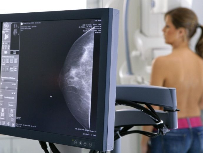 Маммография – «золотой стандарт» диагностики всех известных вариантов рака молочной железы