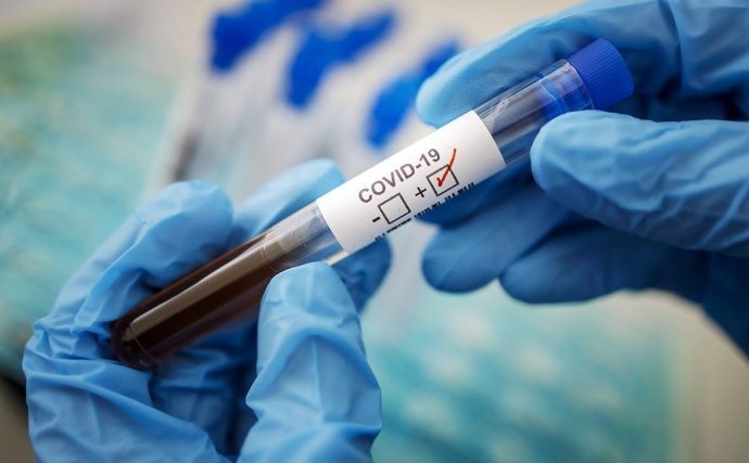 В начале 2023 года штамм коронавируса «цербер» станет преобладающим в России