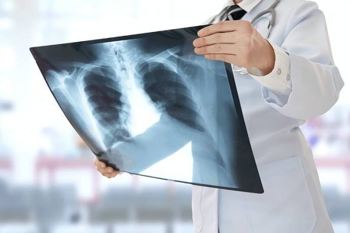 В Павло‑Слободской сельской участковой больнице заработал рентген‑кабинет